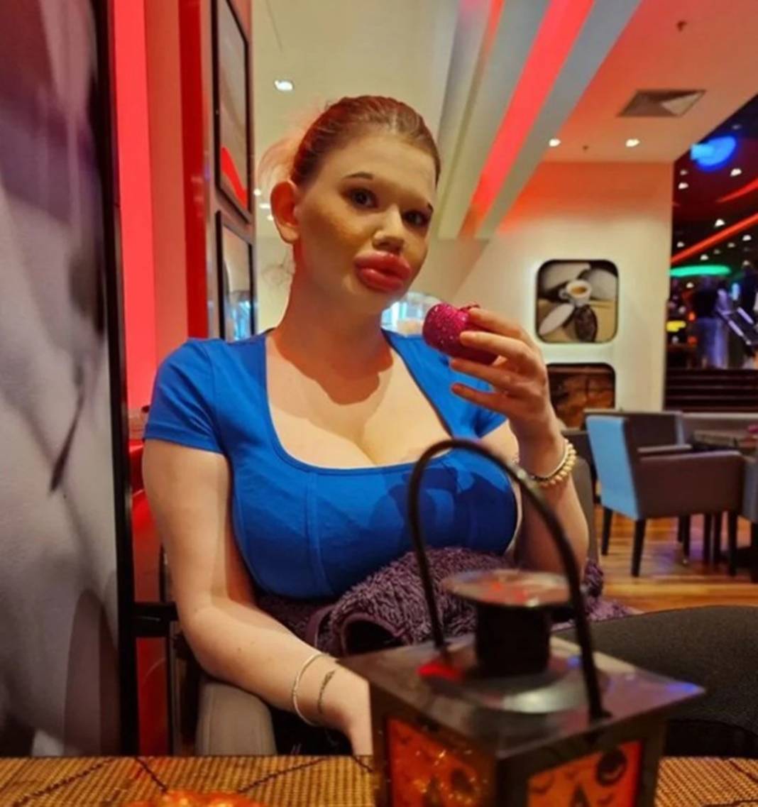 Dudak estetiğine harcadığı para 'dudak' uçuklattı 7